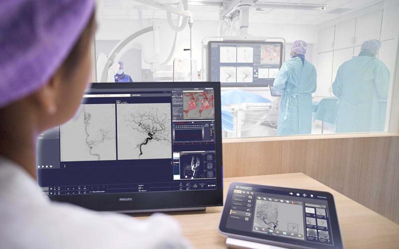 Kemenkes dan Philips Perluas Akses Cathlab Canggih ke 38 Provinsi