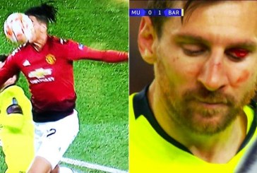 Wajah Messi Berdarah Dihantam Bek Raksasa