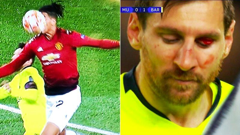Wajah Messi Berdarah Dihantam Bek Raksasa