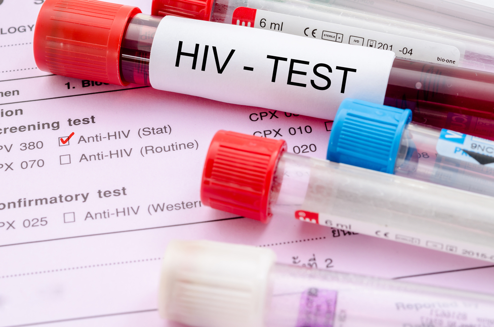 Tes Kesehatan, Pelaku ‘Seks Gangbang’ Positif HIV