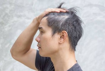 6 Faktor Kenapa Masih Muda Rambut Sudah Ubanan