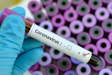 Cegah Virus Corona, Pemerintah Harus Optimalkan LBM Eijkman