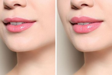 Cara Rawat Bibir Agar Terlihat Lembut dan Cantik