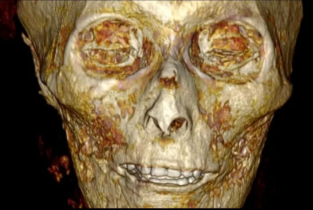 Wow! Mumi Firaun Berusia 3.000 Tahun Dilihat dengan CT Scan