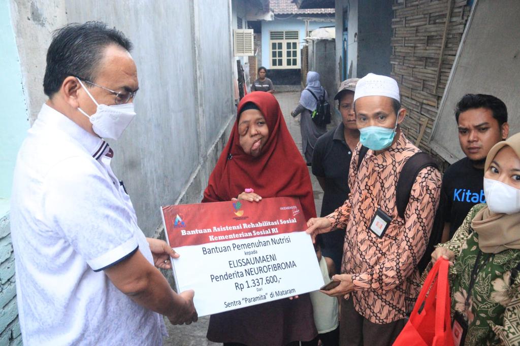 Kemensos Kunjungi Elissaumaeni yang Menderita Neurofibroma di Lombok Timur