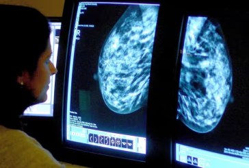 Temuan: Penggunaan AI dalam Skrining Kanker Payudara Sebaik Dua Ahli Radiologi